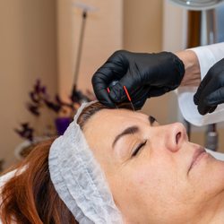 Jane Catania, DACM - Acupuncture Health NJ