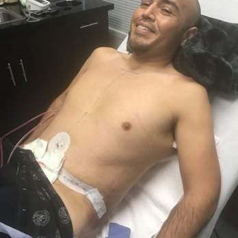 Paul Chugay, MD - The day after my tummy tuck and liposuction. My stomach is flat and smooth. - Cosmetic Surgeons Near Me - Long Beach, California