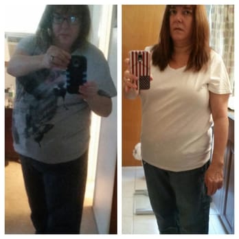Nutrimost - Before and After 28# in 40 days. Planning on 2nd session to lose the rest. - Weight Loss Centers Near Me - Nanuet, New York