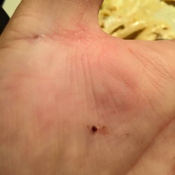 Mambo Italiano Cafe - We killed 6 fruit flies during our meal, with dozens more flying in our faces - Italian Near Me - Bellingham, Washington Mambo Italiano Cafe - We killed 6 fruit flies during our meal, with dozens more flying in our faces - Italian Near Me - Bellingham, Washington