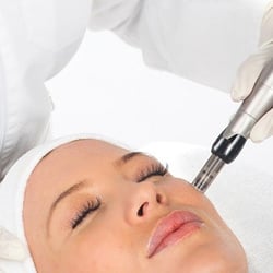 Espai Vallespir59 - Tratamientos con dermapen