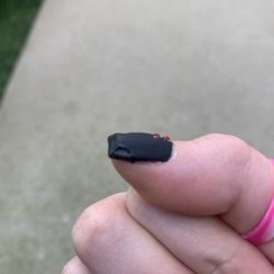 Mercie Nails of Palos Heights - Thumb is peeling