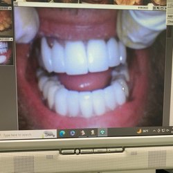 A Belmont Dental Care - After photo