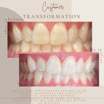 Enchanted Smiles - Teeth Whitening Near Me - Dover, New Hampshire Enchanted Smiles - Teeth Whitening Near Me - Dover, New Hampshire