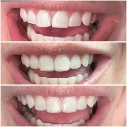 Jack Ringer, DDS