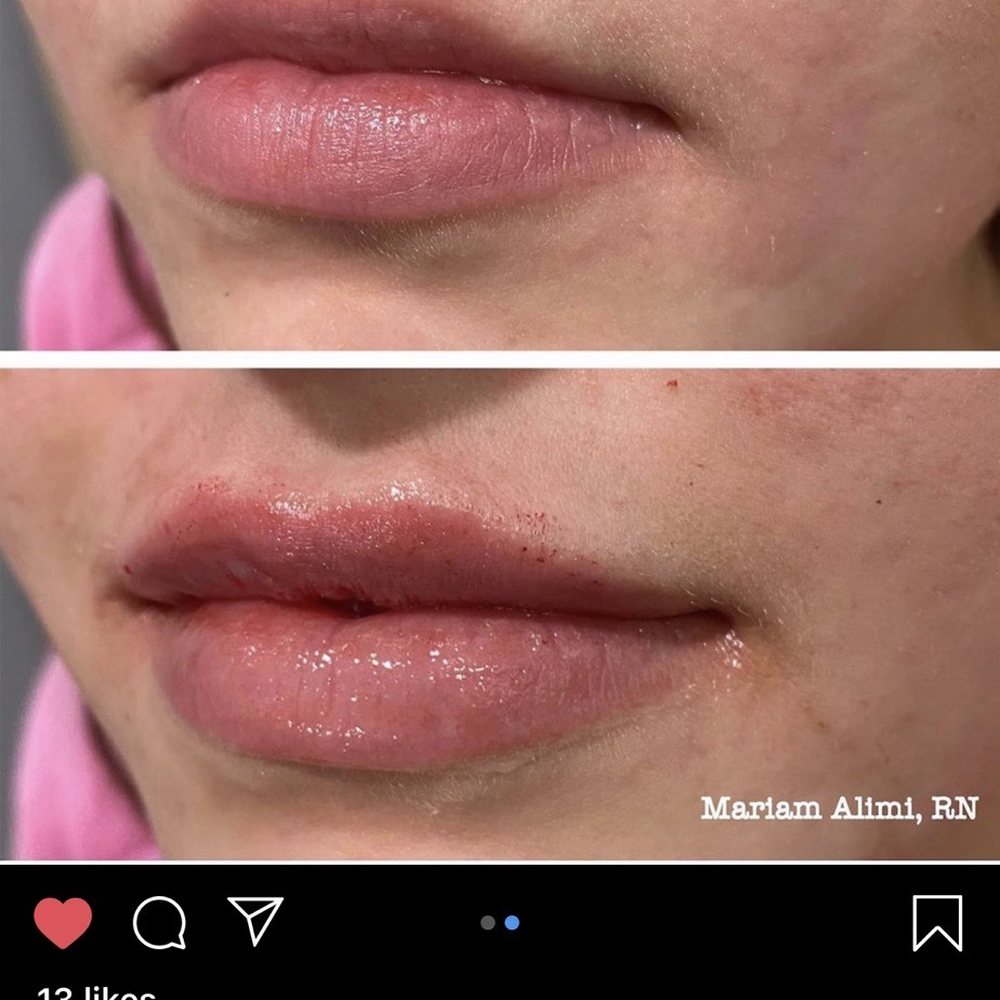 Impressions MedSpa - Laser Hair Removal Near Me - Fairfax, Virginia Impressions MedSpa - Laser Hair Removal Near Me - Fairfax, Virginia