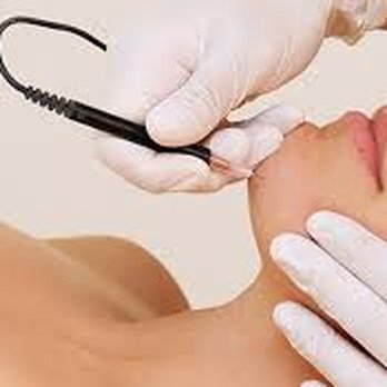 South Coast Electrolysis - Hair Removal Near Me - Corona Del Mar, California South Coast Electrolysis - Hair Removal Near Me - Corona Del Mar, California