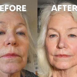 Janet Vafaie, MD, FAAD