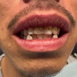 Risas Dental and Braces - Commerce City