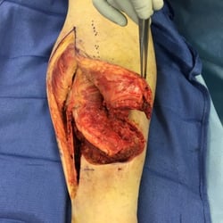Lower Limb Institute: Mina Abadeer, DPM