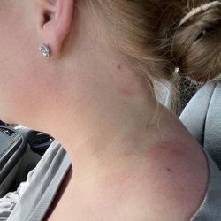 High Desert Rolfing - Neck pre treatment