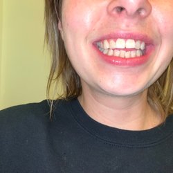 Brigham Orthodontics - BEFORE - May 2021