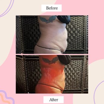 La Curves Spa - Body Contouring Near Me - Bell, California La Curves Spa - Body Contouring Near Me - Bell, California