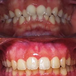 Smiles Cafe Dentistry