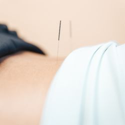 Shawn Meirovici, ND - Acupuncture