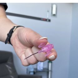 Vida-Flo Buckhead - IV Hydration - Catheter removed after being stuck 4 times in different sites - Keith disputes this claim yet refuses to provide evidence.