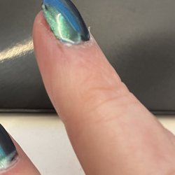Millenia Nails & Spa - Healing cut from aggressive filing