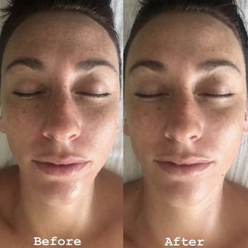 Danelle Skincare - Gua Sha facial with lymphatic drainage and massage. - Estheticians Near Me Danelle Skincare - Gua Sha facial with lymphatic drainage and massage. - Estheticians Near Me