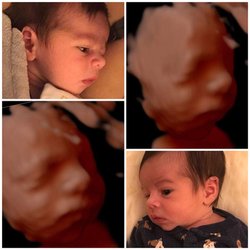 Moms To Be Ultrasound
