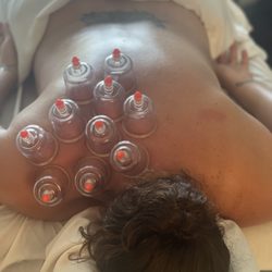 Mobile Massage by Juliana Pallesi - Cupping treatment