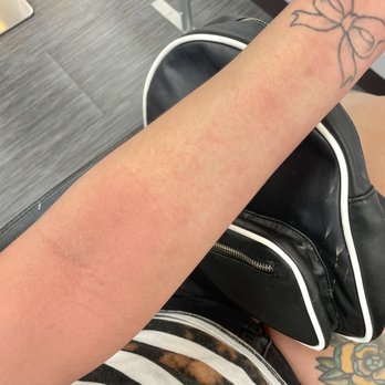 Yashi - HEAT HIVES FROM NOT ENOUGH VENTILATION IN SALON. - Hair Salons Near Me - Westminster, California Yashi - HEAT HIVES FROM NOT ENOUGH VENTILATION IN SALON. - Hair Salons Near Me - Westminster, California