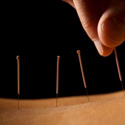Perfect Point Acupuncture