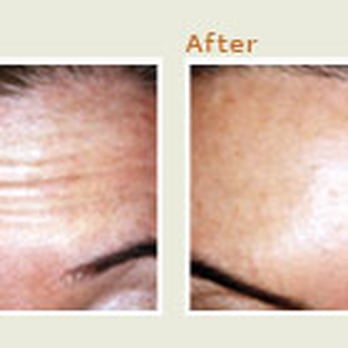 Carr Dermatology - Tattoo Removal Near Me - Sugar Land, Texas Carr Dermatology - Tattoo Removal Near Me - Sugar Land, Texas