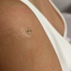 Jeffrey Lauber-Advanced Skin Treatment Center of Orange County