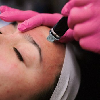 Clover Skin Bar - The best skin of your life with our Hydrafacial. A patented technology to cleanse, exfoliate, hydrate and pump your skin full of peptides! - Skin Care Near Me - Lindon, Utah Clover Skin Bar - The best skin of your life with our Hydrafacial. A patented technology to cleanse, exfoliate, hydrate and pump your skin full of peptides! - Skin Care Near Me - Lindon, Utah