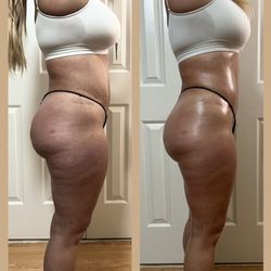 BodySculpt305