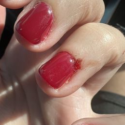 Bloody nails Bloody nails