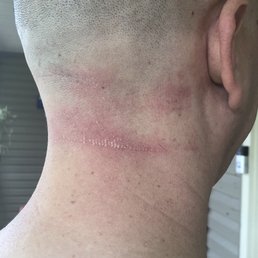 Cut me with extremely dull razors. Not even concerned about my clearly bleeding wound. Cut me with extremely dull razors. Not even concerned about my clearly bleeding wound.