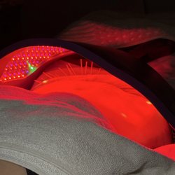 AcuSpa Wellness Center - Acupuncture + Celluma light therapy combo