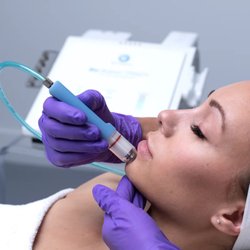 Skincare By Hadiyah - MICRODERM facial treatment featuring the Bio-Brasion Trinity Microdermabrasion machine