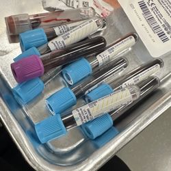 Arup Blood Services - Ouch