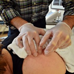 Dee Physical Therapy - Dee PT offers Dry Needling as well!