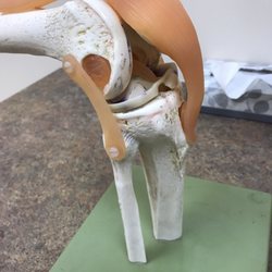 Orthopedic Associates of Hartford - Model of a shoulder, bones muscles & tendons. (I think?)