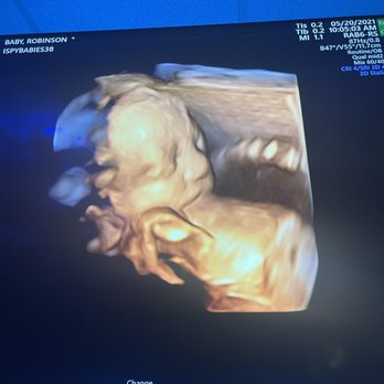I Spy Babies - Early on, but ispy was able to get amazing photos; way better than my doctor - Ultrasound Imaging Centers Near Me - Tampa, Florida I Spy Babies - Early on, but ispy was able to get amazing photos; way better than my doctor - Ultrasound Imaging Centers Near Me - Tampa, Florida