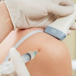 ReNew Medical Center - Joint Injections