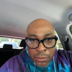 Harlem Zen - Harlem Zen Atlanta - Laser Hair Removal / Bald Head!