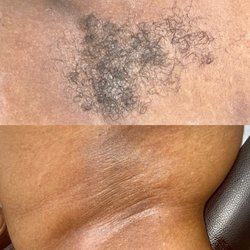 destinyericaesthetics - Underarm wax