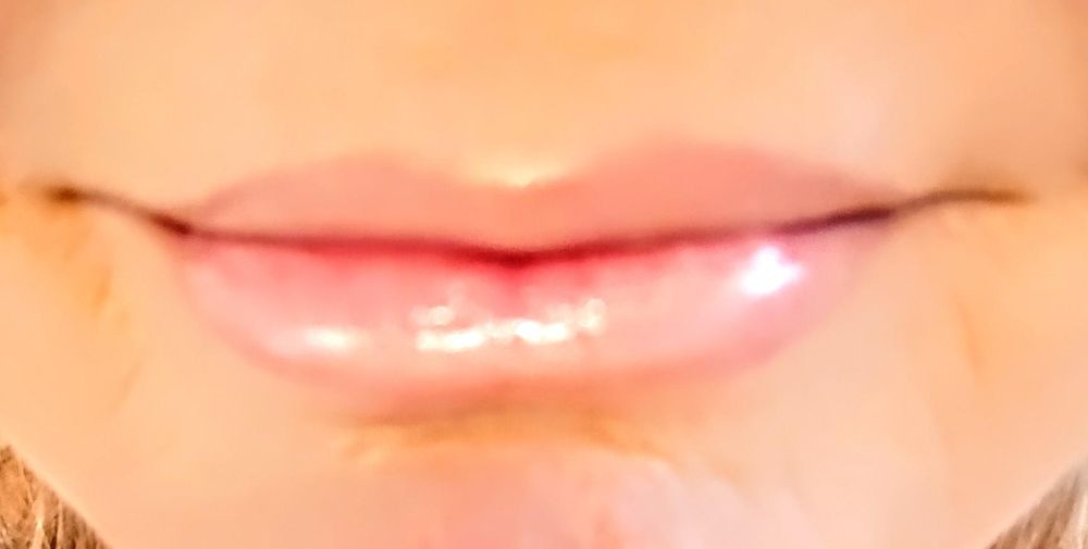 Salt Lake Dental - patient advocate in Lake City, UT