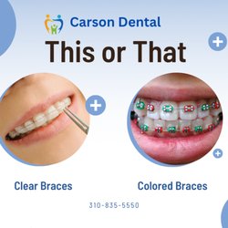 Carson Dental - Free Consultation