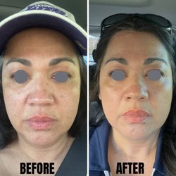 SkinRenew Laser Medical Center - A Brighter, Smoother-Looking Complexion.