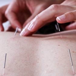 Sea Dragon Acupuncture & Herb Clinic - Acupuncture to treat pain, injuries, or internal disorders such as insomnia, depression, headaches/migraines, etc.