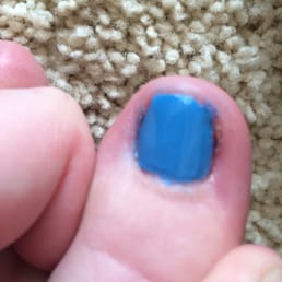 Horrible job.