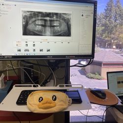 WALNUT CREEK OPTOMETRY GROUP - #TravelsWithDucky celebrating not having teeth