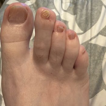 Aesthetics Nail Spa - This is the after photo - Nail Salons Near Me - Olympia, Washington Aesthetics Nail Spa - This is the after photo - Nail Salons Near Me - Olympia, Washington