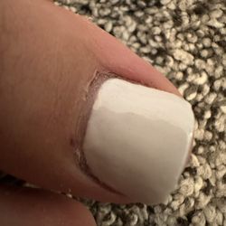 Kt Nails - Cut into my daughter's skin all around her big toe!