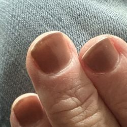 Wear at tops of nails.